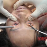 Chinese woman autopsy