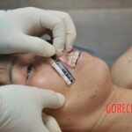 Chinese woman autopsy