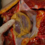 Chinese woman autopsy