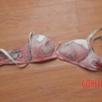 Chinese woman autopsy