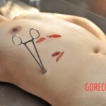 Chinese woman autopsy