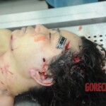 Examination of dead female