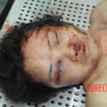 Examination of dead female