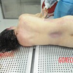 Examination of dead female