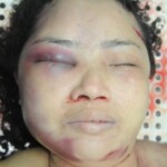 Examination of dead female