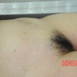 Examination of dead female