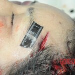 Examination of dead female