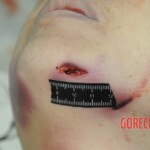 Examination of dead female