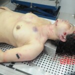 Examination of dead female