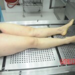 Examination of dead female