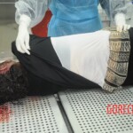 Examination of dead female