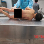 Examination of body of little Chinese girl