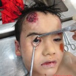 Examination of body of little Chinese girl