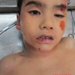 Examination of body of little Chinese girl