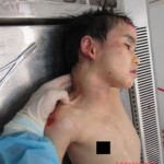 Examination of body of little Chinese girl