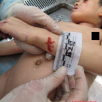 Examination of body of little Chinese girl