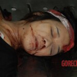 Examination of dead woman