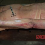 Examination of dead woman