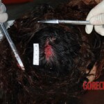 Examination of dead woman