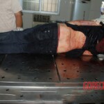 Examination of dead woman