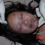 Tortured Chinese girl