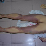 Tortured Chinese girl