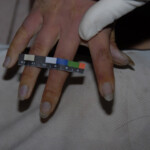 Tortured Chinese girl