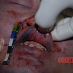 Tortured Chinese girl