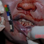 Tortured Chinese girl