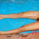 Murdered Thai prostitute