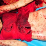 Murdered Thai prostitute