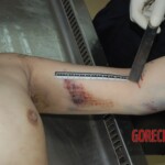 Naked woman in morgue