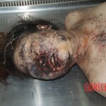 Naked woman in morgue