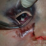 Naked woman in morgue