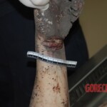 Naked woman in morgue