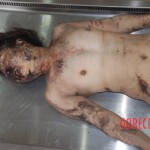 Naked woman in morgue