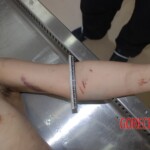 Naked woman in morgue