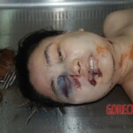 Naked woman in morgue