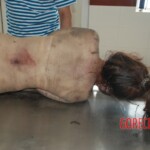 Naked woman in morgue