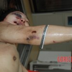 Naked woman in morgue