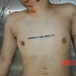 Naked woman in morgue