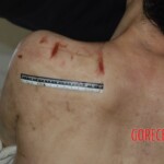 Naked woman in morgue