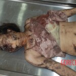 Naked woman in morgue