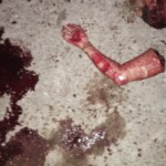 Beheaded and dismembered woman