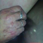 Dead Ukrainian woman