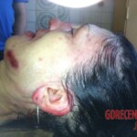 Dead Ukrainian woman