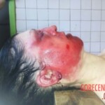 Dead Ukrainian woman