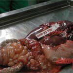 Autopsy of a drug mule