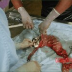 Autopsy of a drug mule