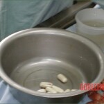 Autopsy of a drug mule